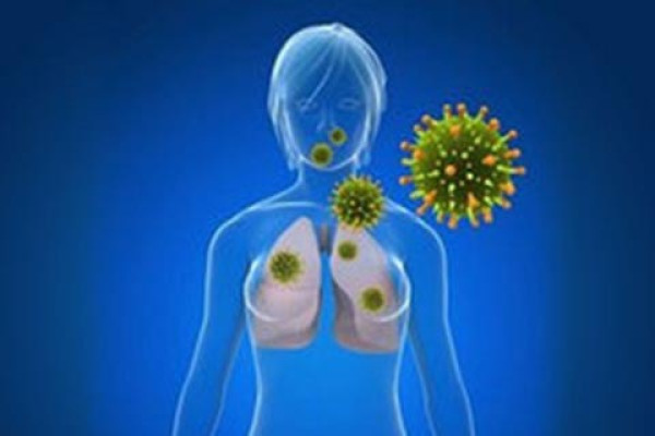 Middle East Respiratory Syndrome: Viral infection found in 1 out of every 3 pilgrims returning from Saudi Arabia with respiratory illness: Study